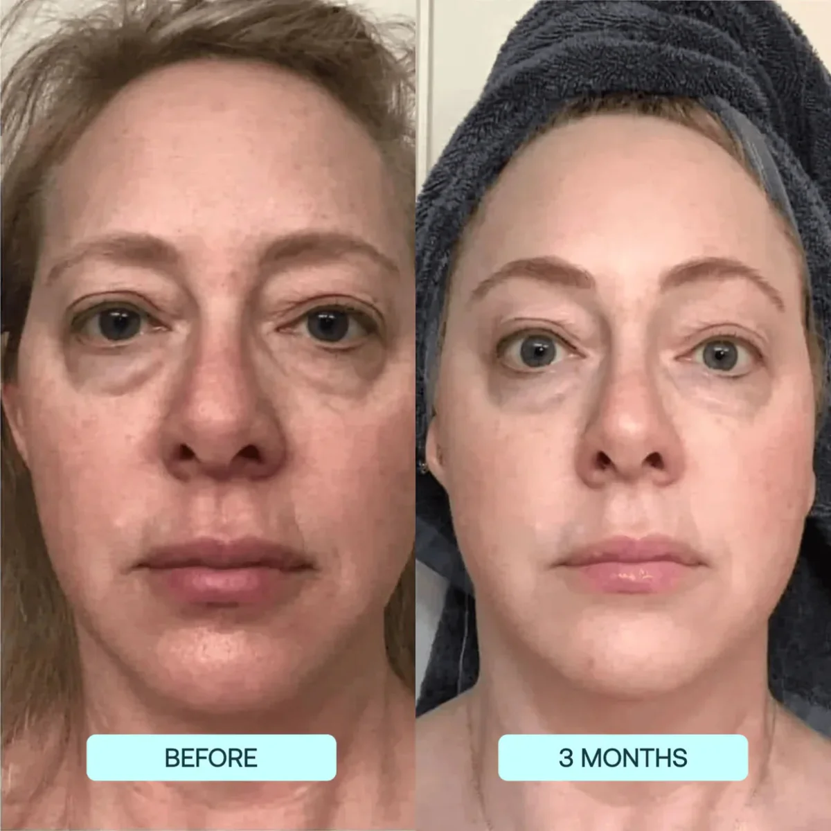 NANO SKIN™  FACE REJUVENATION ANTI AGING FORMULA COLLAGEN FILMS - Image 3