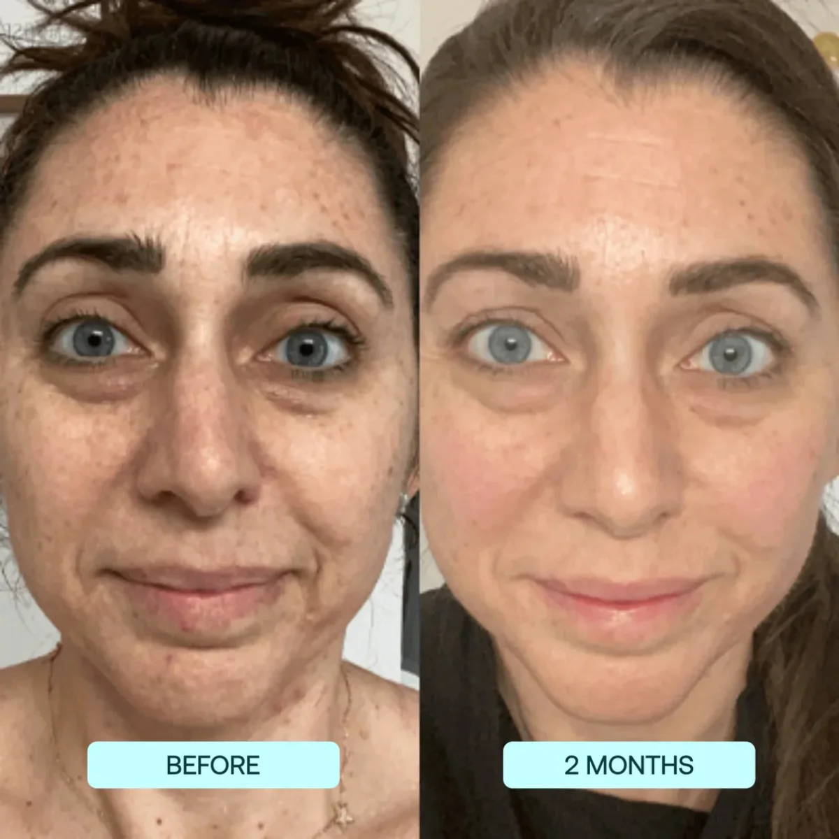 NANO SKIN™  FACE REJUVENATION ANTI AGING FORMULA COLLAGEN FILMS - Image 4