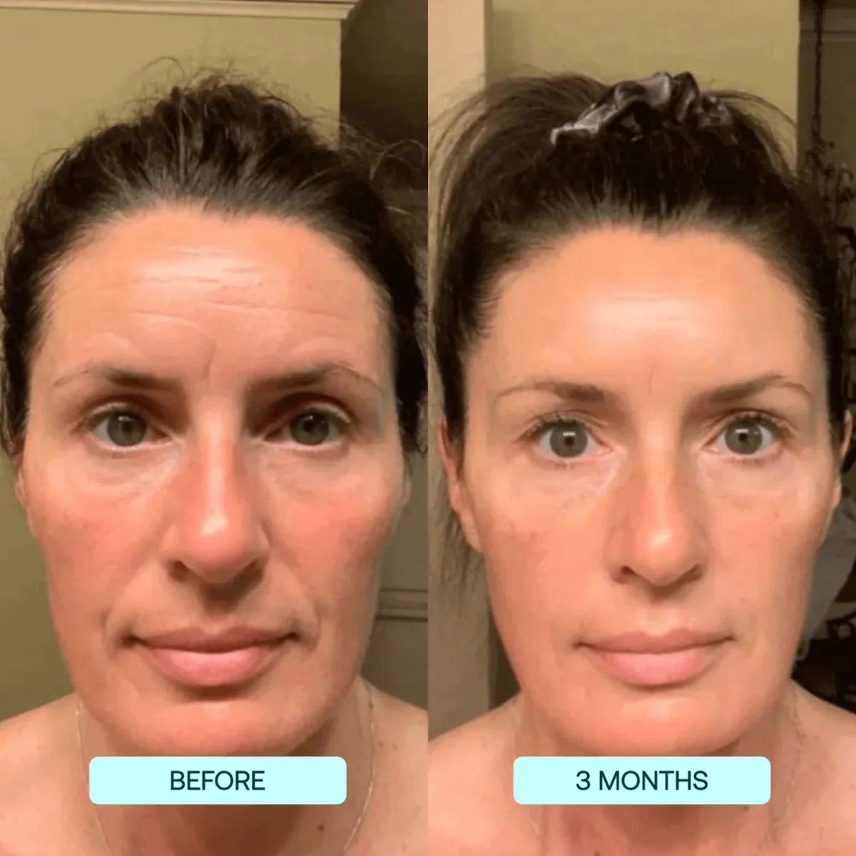 NANO SKIN™  FACE REJUVENATION ANTI AGING FORMULA COLLAGEN FILMS - Image 5